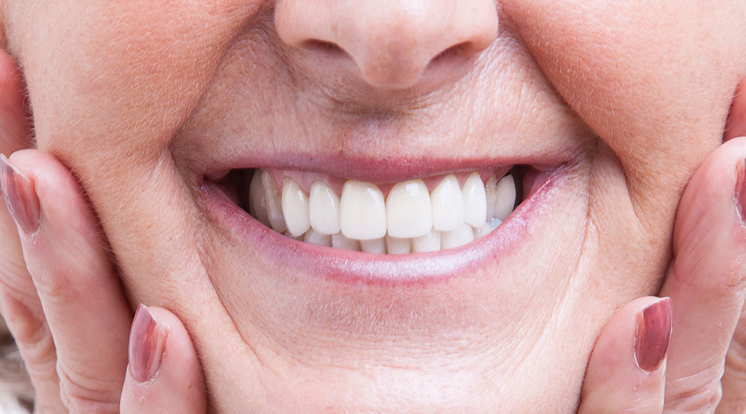 Dental Implants What to Expect
