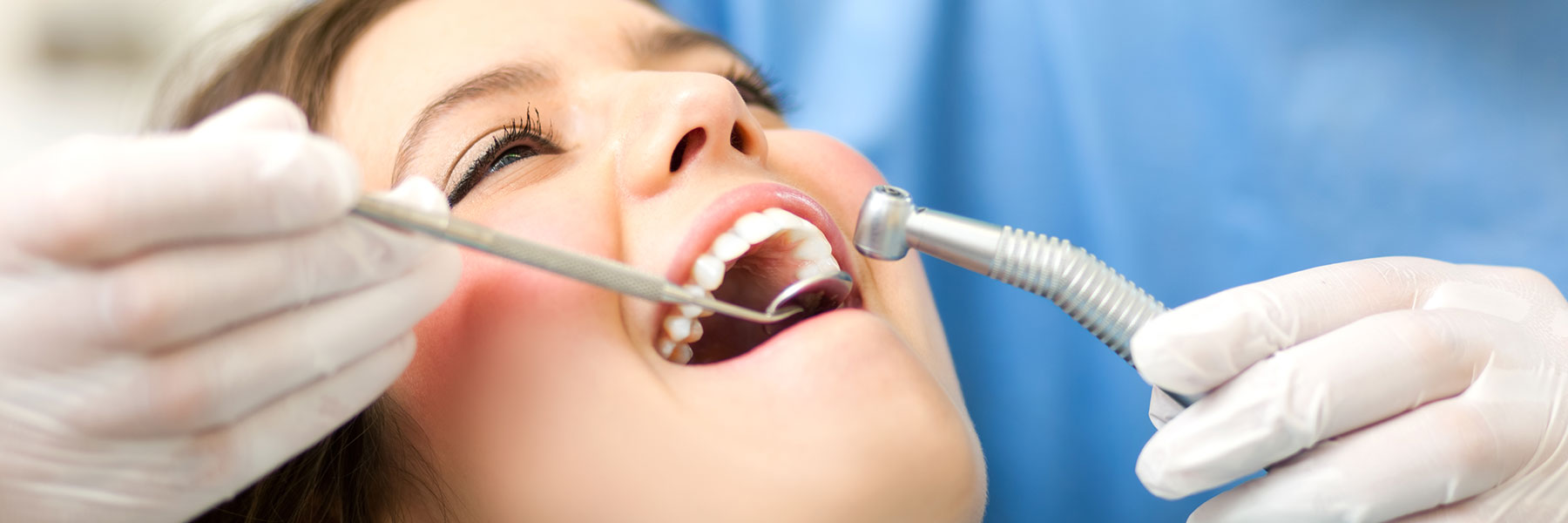Periodontal Deep Cleaning